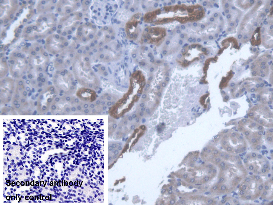 Polyclonal Antibody to Thiosulfate Sulfurtransferase (TST)