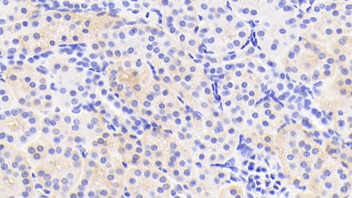 Polyclonal Antibody to Tissue Specific Transplantation Antigen P35B (TSTA3)