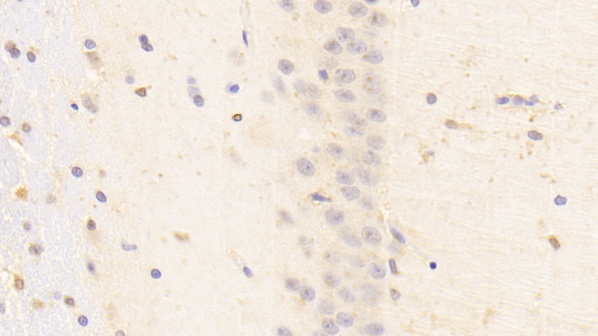 Polyclonal Antibody to Thyroid Stimulating Hormone Receptor (TSHR)