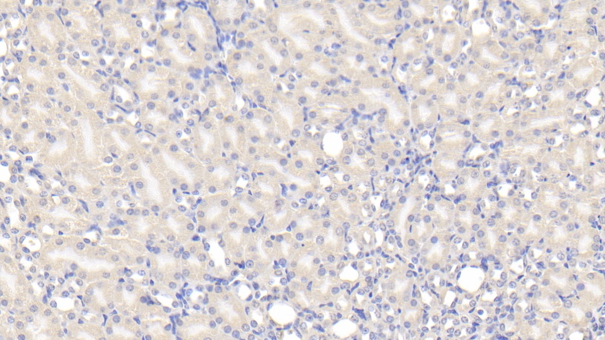 Polyclonal Antibody to Tuftelin (TUFT)