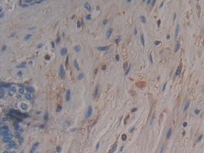 Polyclonal Antibody to Adenylyl Cyclase Associated Protein 2 (CAP2)