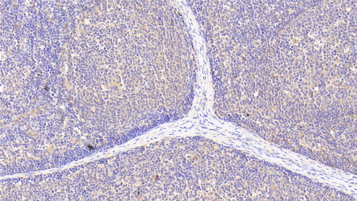 Polyclonal Antibody to Sterol Carrier Protein 2 (SCP2)