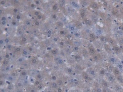 Polyclonal Antibody to Sterol Carrier Protein 2 (SCP2)