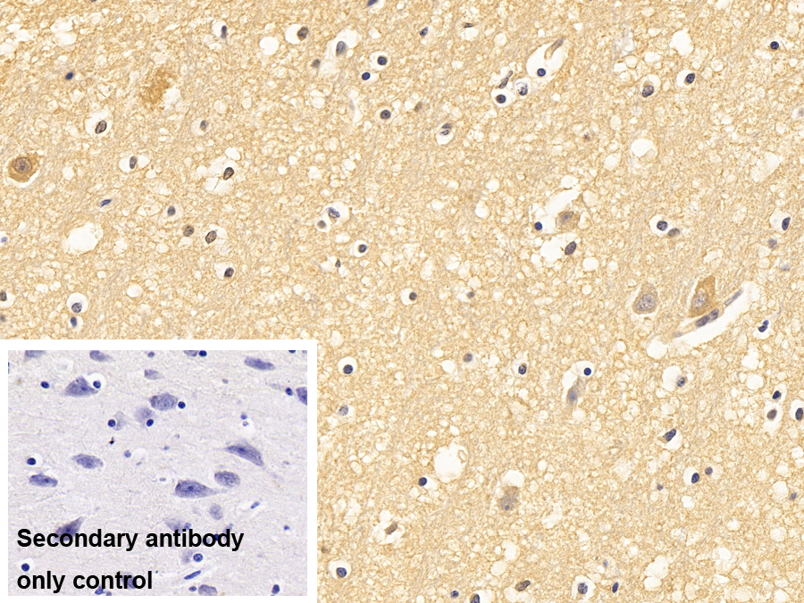 Polyclonal Antibody to Secernin 1 (SCRN1)