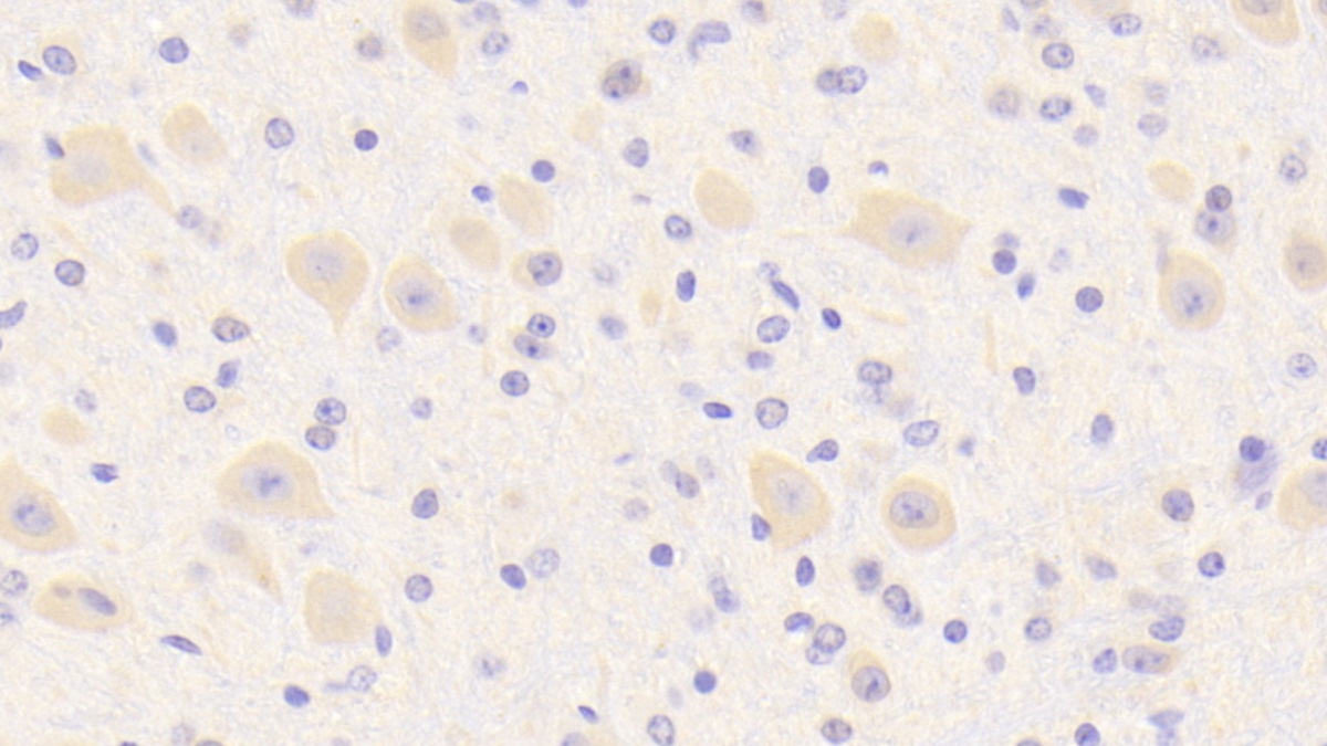 Polyclonal Antibody to Secernin 1 (SCRN1)