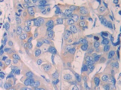 Polyclonal Antibody to Renalase (RNLS)