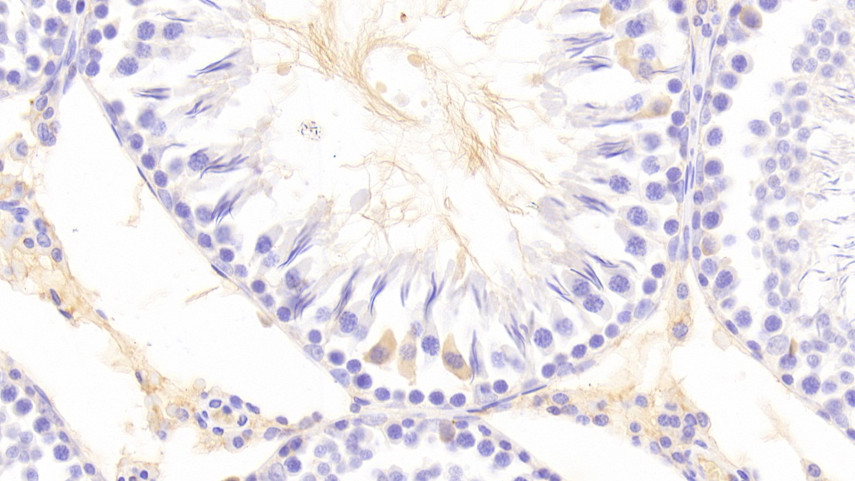 Polyclonal Antibody to Src Kinase Associated Phosphoprotein 1 (SKAP1)