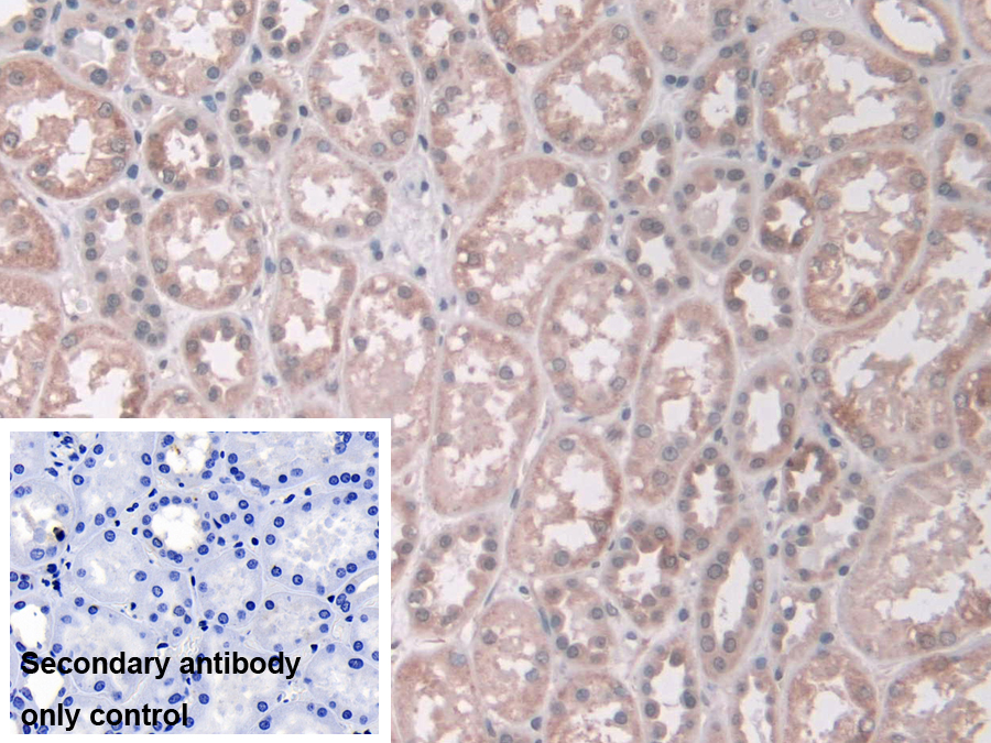 Polyclonal Antibody to Aminoadipate Semialdehyde Synthase (AASS)