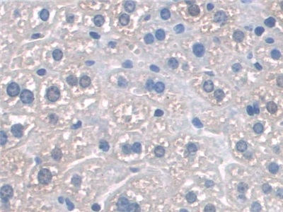 Polyclonal Antibody to Synaptosomal Associated Protein 23kDa (SNAP23)