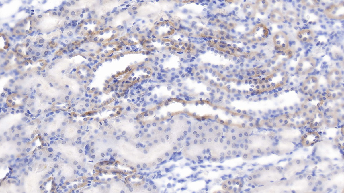 Polyclonal Antibody to Synuclein Alpha Interacting Protein 1 (SNCaIP1)