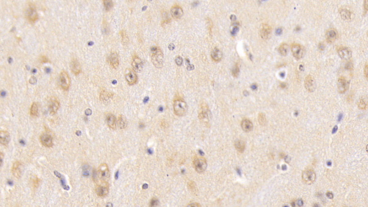 Polyclonal Antibody to Snurportin 1 (SNUPN1)