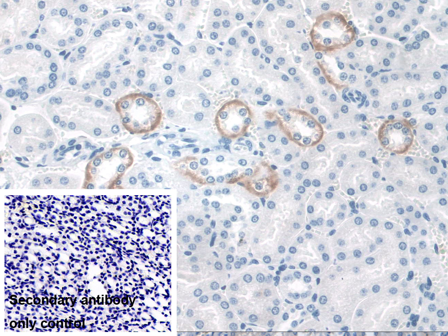 Polyclonal Antibody to Signal Transducing Adaptor Molecule 2 (STAM2)