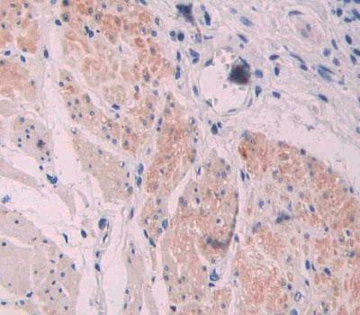 Polyclonal Antibody to Supervillin (SVIL)