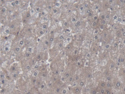 Polyclonal Antibody to Symplekin (SYMPK)