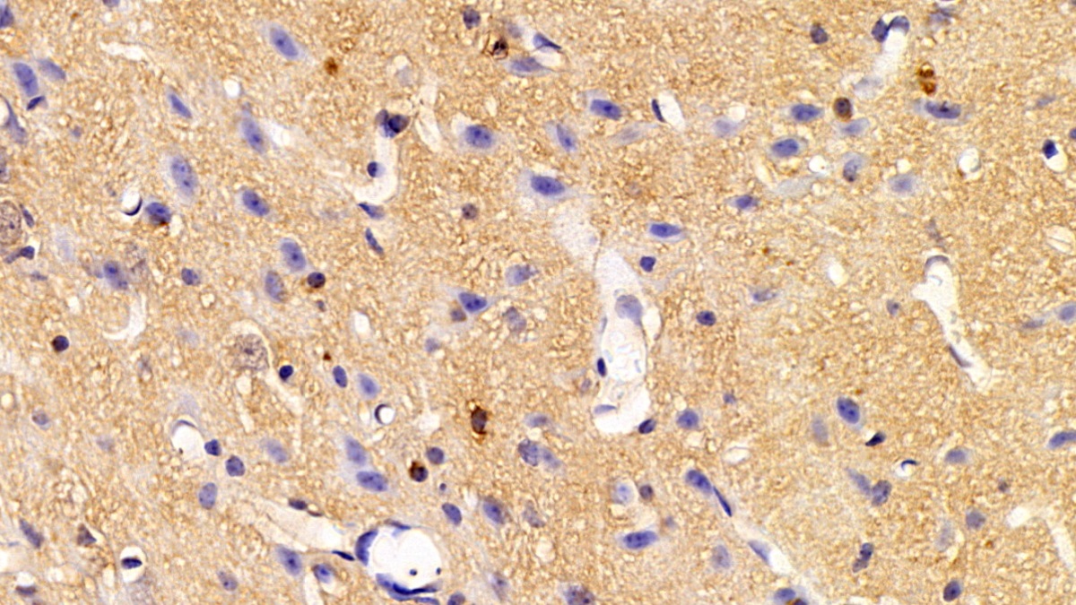 Polyclonal Antibody to Synapsin I (SYN1)