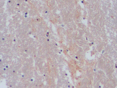 Polyclonal Antibody to Serotonin Transporter (SERT)