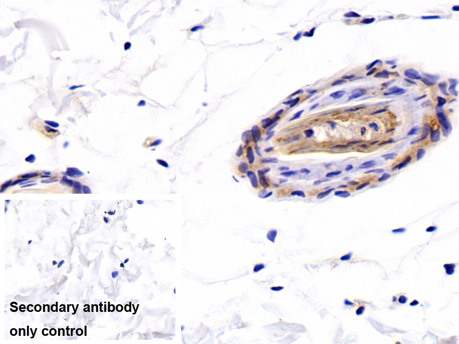 Polyclonal Antibody to Dermcidin (DCD)