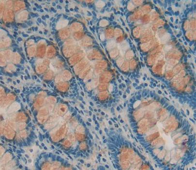 Polyclonal Antibody to Deoxyhypusine Synthase (DHPS)