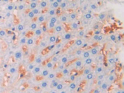 Polyclonal Antibody to Fibroblast Growth Factor 13 (FGF13)