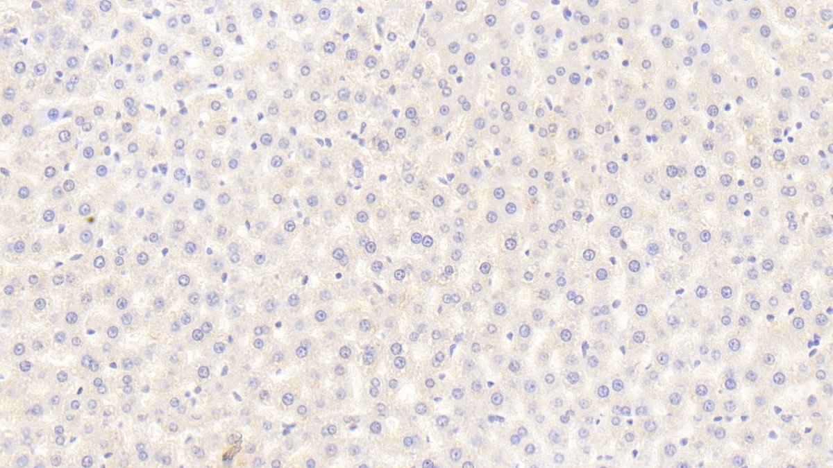 Polyclonal Antibody to Fibroblast Growth Factor 21 (FGF21)