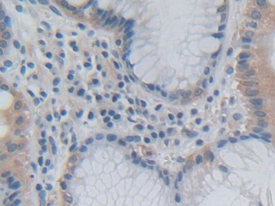 Polyclonal Antibody to Growth Hormone 2 (GH2)