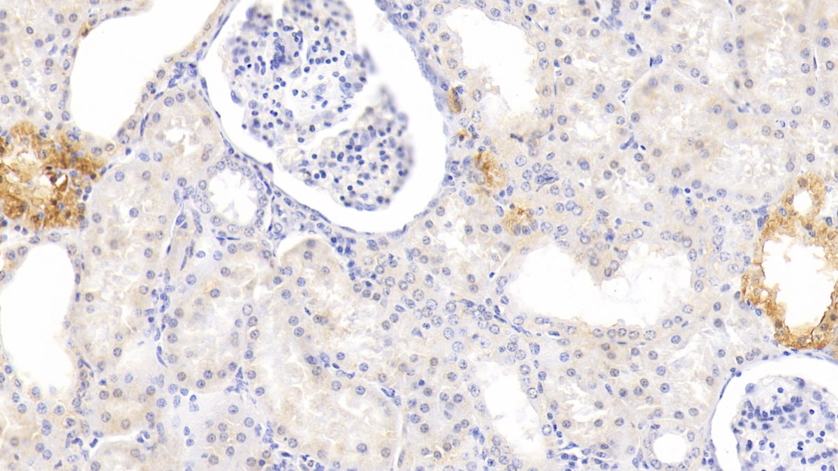 Polyclonal Antibody to Melatonin Receptor 1A (MTNR1A)