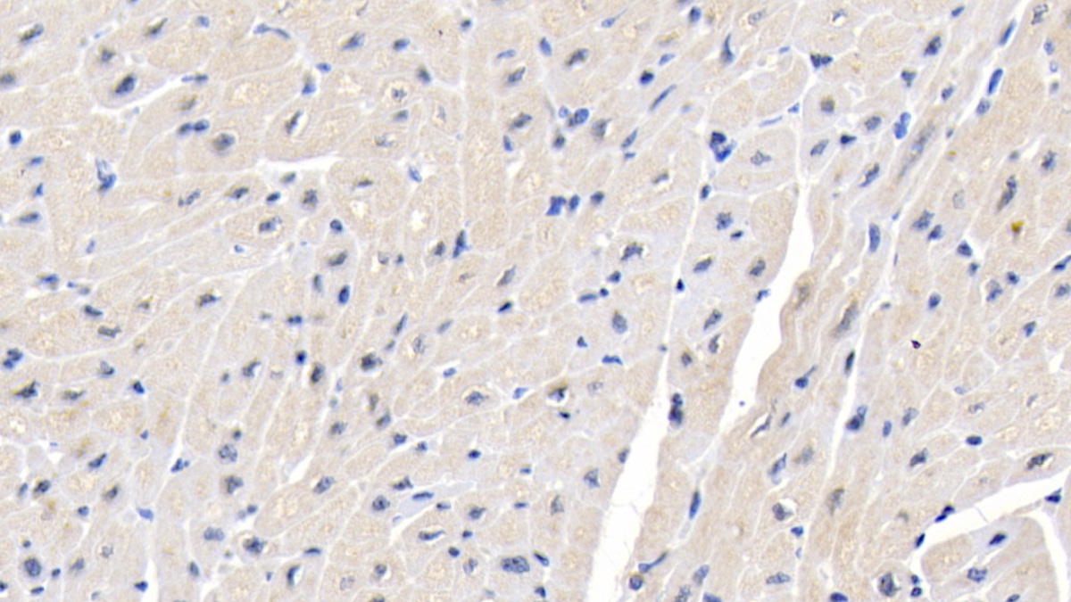 Polyclonal Antibody to Melanin Concentrating Hormone Receptor 1 (MCHR1)