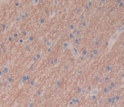 Polyclonal Antibody to Tectorin Beta (TECTb)