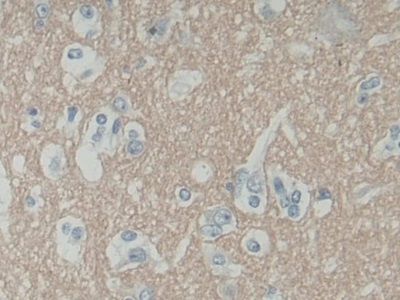 Polyclonal Antibody to Synaptosomal Associated Protein 25kDa (SNAP25)