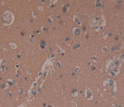 Polyclonal Antibody to Synaptosomal Associated Protein 25kDa (SNAP25)