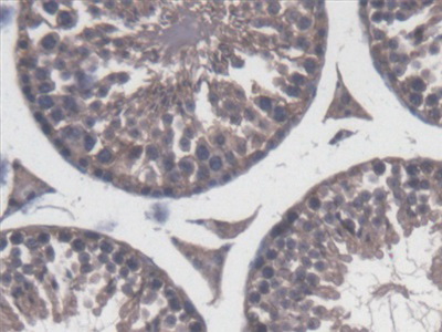 Polyclonal Antibody to Calpain 5 (CAPN5)