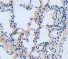 Polyclonal Antibody to Calpain 10 (CAPN10)