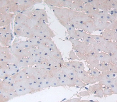 Polyclonal Antibody to Cathepsin B (CTSB)