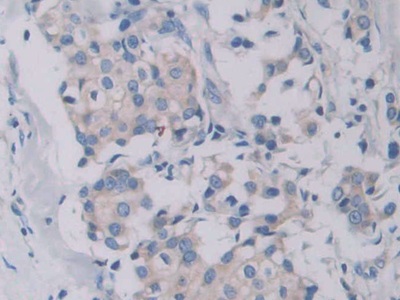 Polyclonal Antibody to Cathepsin C (CTSC)