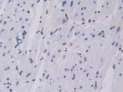 Polyclonal Antibody to Cathepsin C (CTSC)