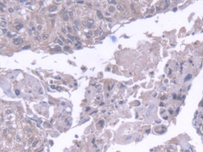 Polyclonal Antibody to Cathepsin H (CTSH)