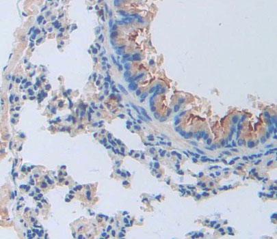 Polyclonal Antibody to Cathepsin W (CTSW)