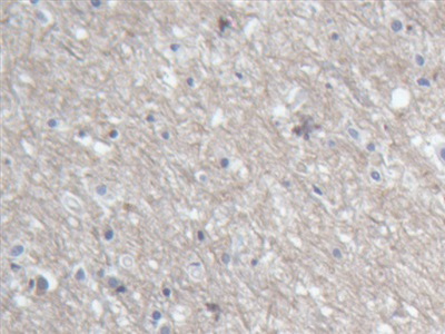 Polyclonal Antibody to Microtubule Associated Protein 1B (MAP1B)