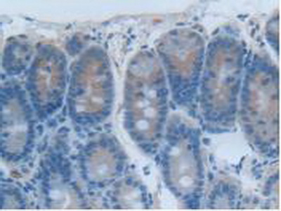 Polyclonal Antibody to Carcinoembryonic Antigen Related Cell Adhesion Molecule 1 (CEACAM1)