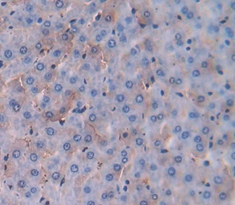 Polyclonal Antibody to Carcinoembryonic Antigen Related Cell Adhesion Molecule 3 (CEACAM3)