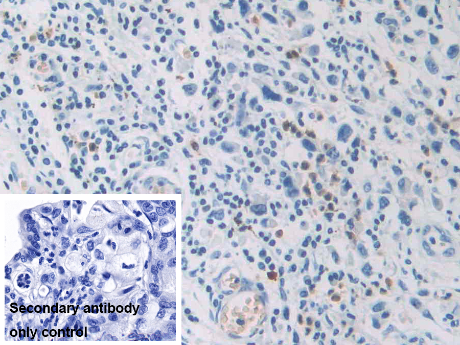 Polyclonal Antibody to Carcinoembryonic Antigen Related Cell Adhesion Molecule 7 (CEACAM7)