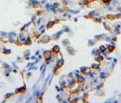 Polyclonal Antibody to Carcinoembryonic Antigen Related Cell Adhesion Molecule 6 (CEACAM6)