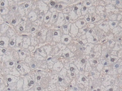 Polyclonal Antibody to Poly ADP Ribose Polymerase 4 (PARP4)