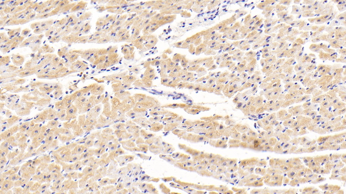 Polyclonal Antibody to Tankyrase 2 (TNKS2)