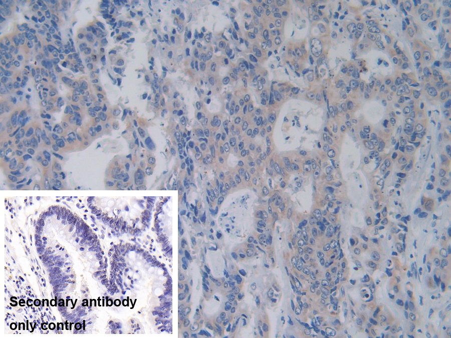 Polyclonal Antibody to Arginyl tRNA Synthetase (RARS)