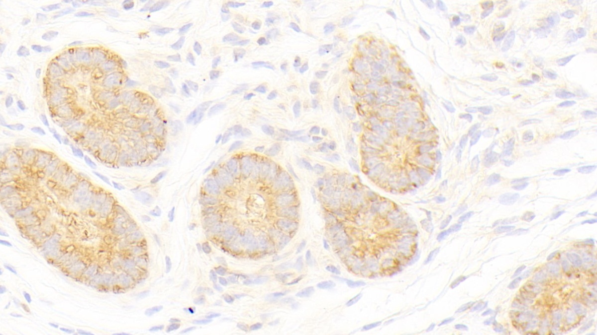 Polyclonal Antibody to Histidyl tRNA Synthetase (HARS)