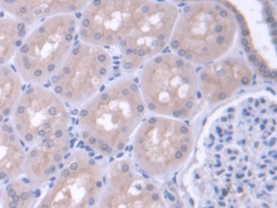 Polyclonal Antibody to Phenylalanyl tRNA Synthetase 2, Mitochondrial (FARS2)