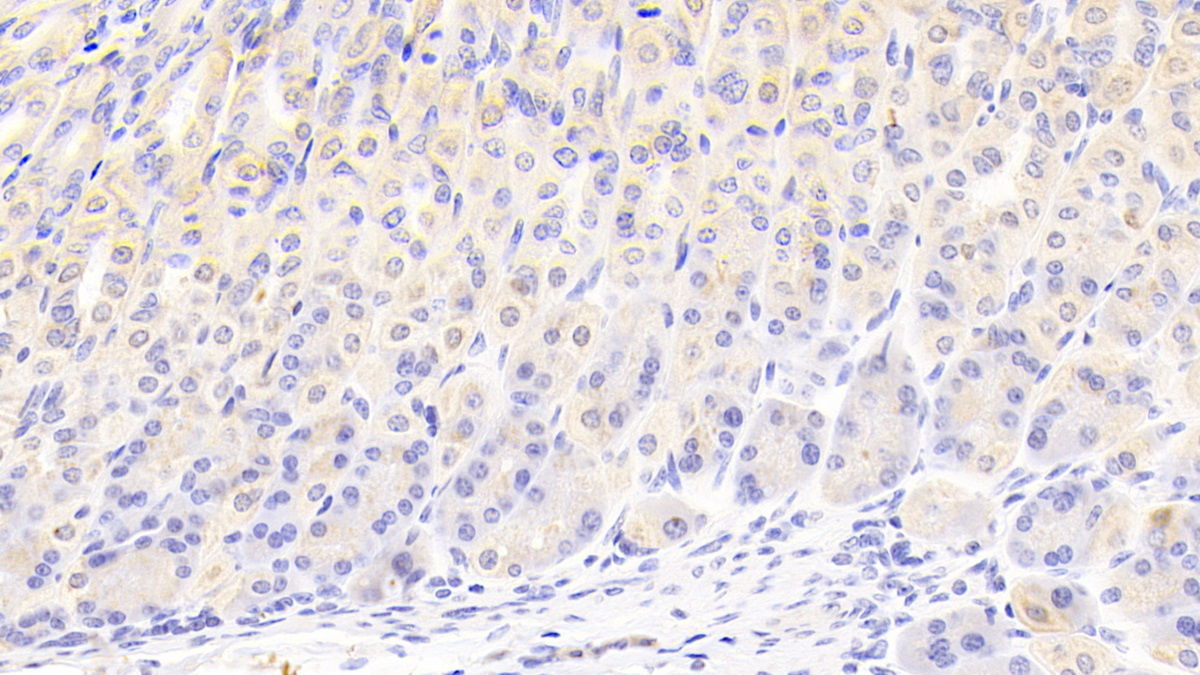 Polyclonal Antibody to Phenylalanyl tRNA Synthetase 2, Mitochondrial (FARS2)