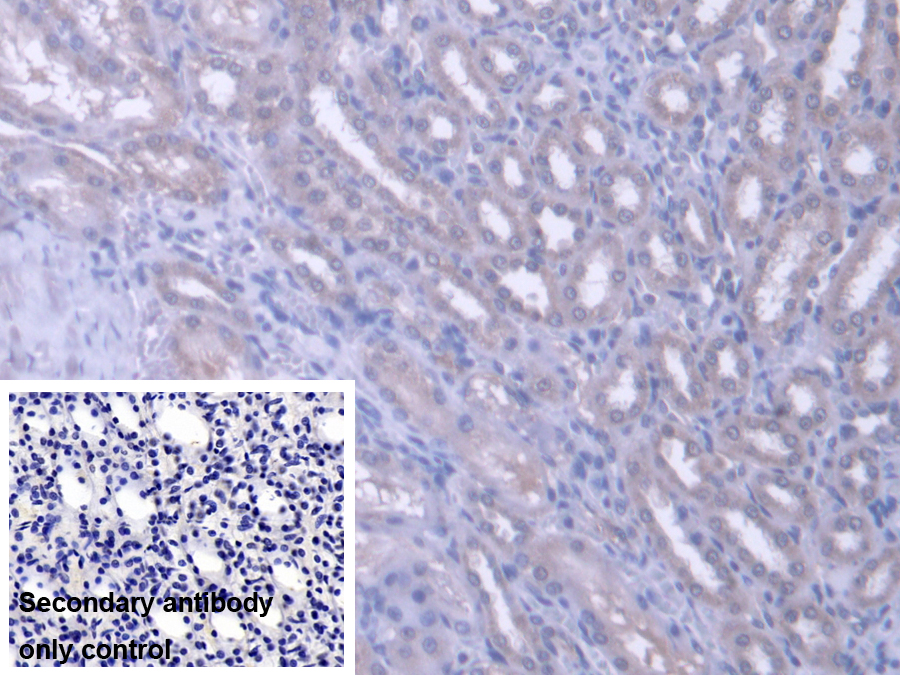 Polyclonal Antibody to Phenylalanyl tRNA Synthetase 2, Mitochondrial (FARS2)