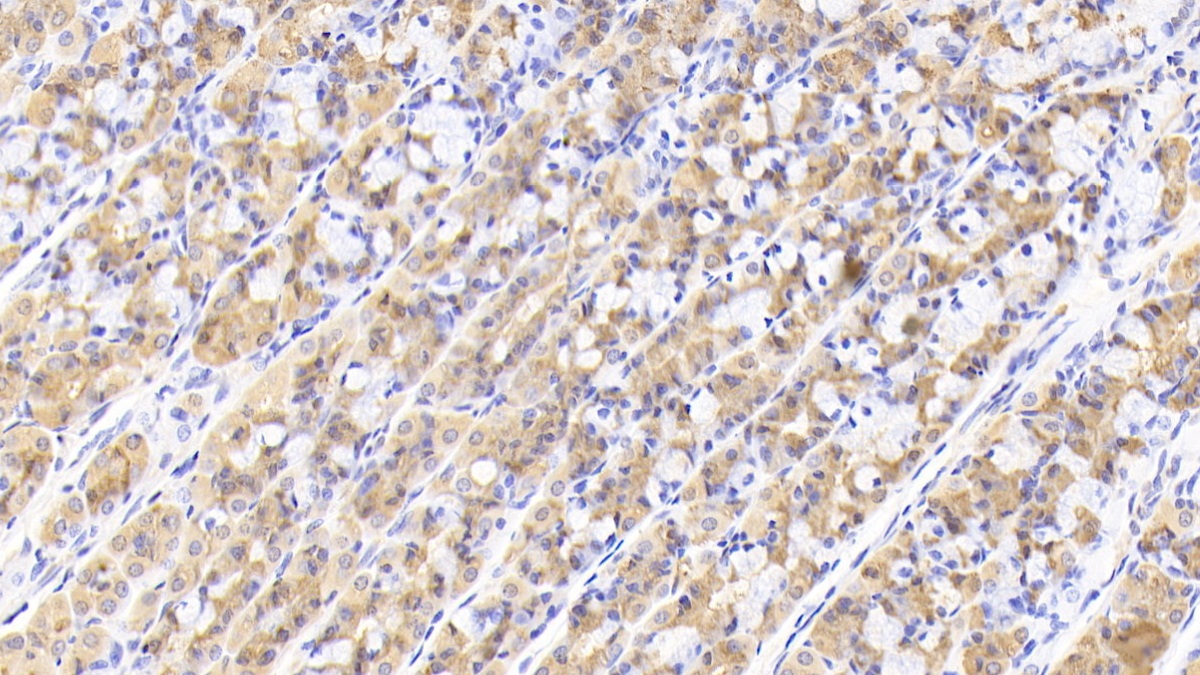 Polyclonal Antibody to Glutaminyl tRNA Synthetase (QARS)